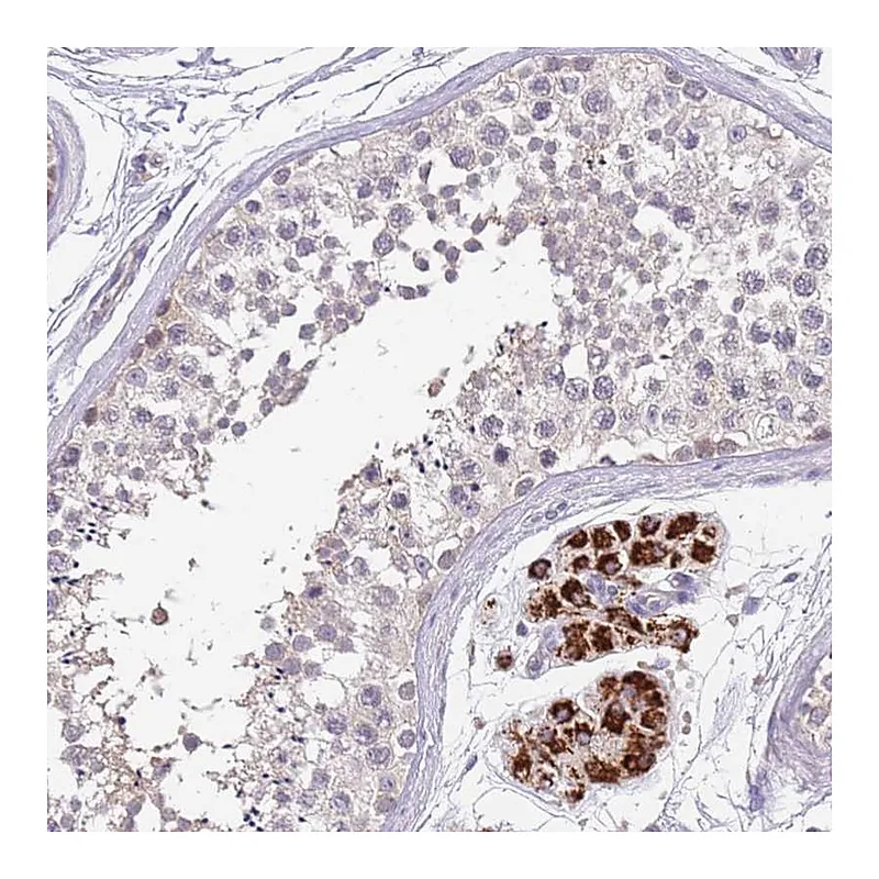 Atlas Antibodies Anti-ZNF746 Antibody