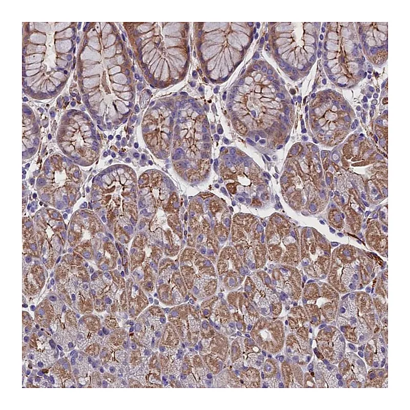 Atlas Antibodies Anti-ZNF749 Antibody