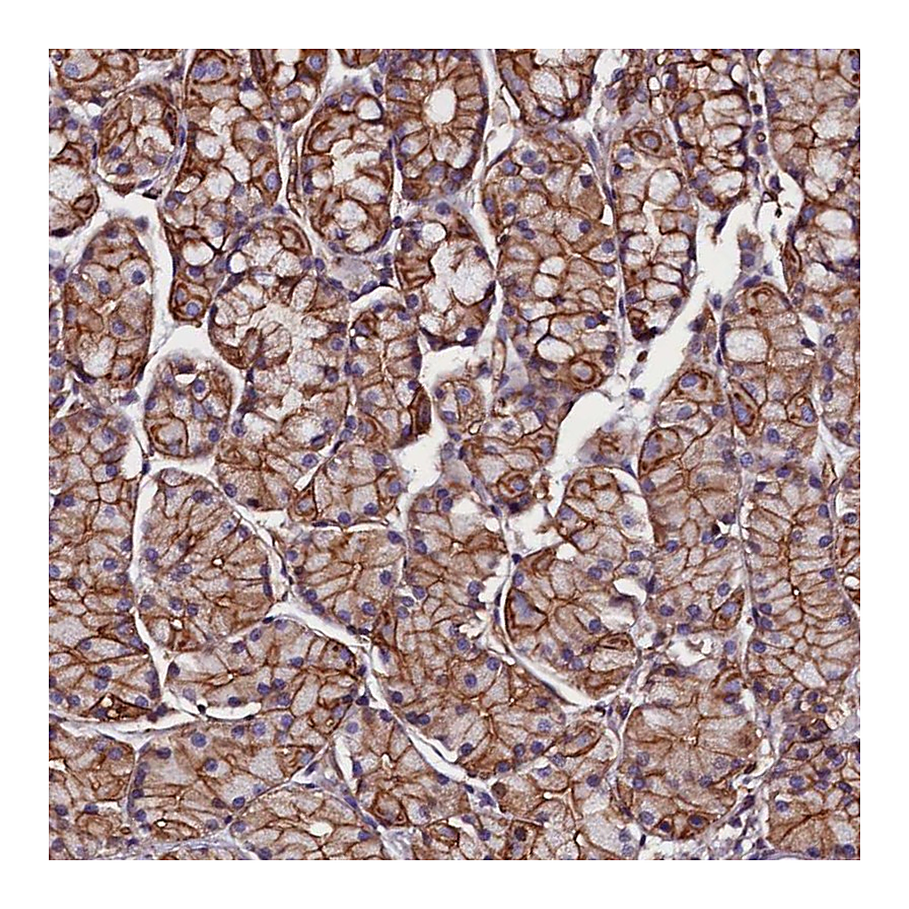 Atlas Antibodies Anti-ZNF749 Antibody