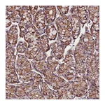 Atlas Antibodies Anti-ZNF749 Antibody