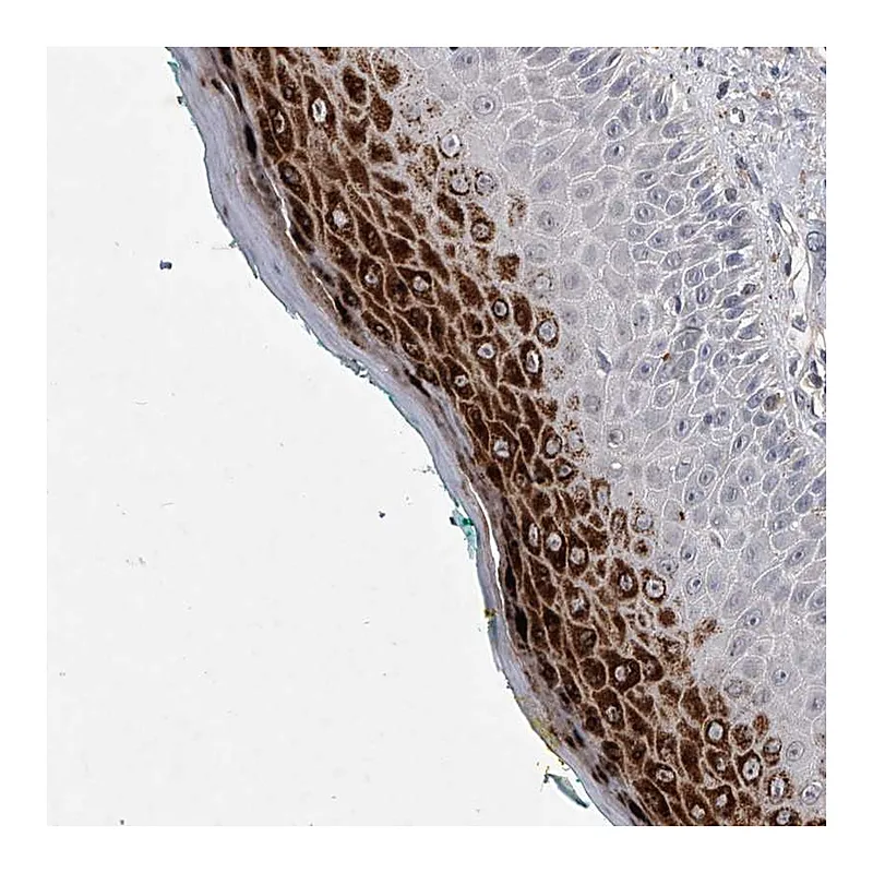 Atlas Antibodies Anti-ZNF76 Antibody
