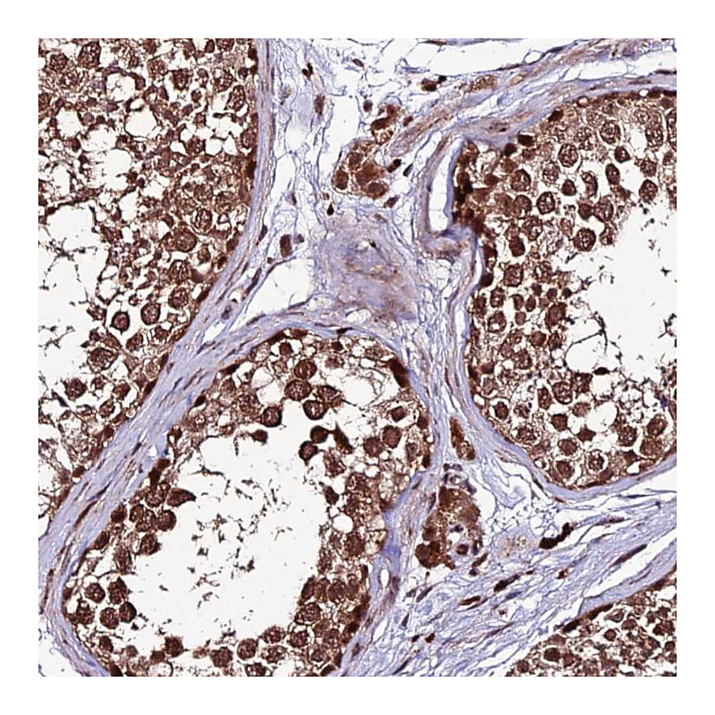 Atlas Antibodies Anti-ZNF766 Antibody