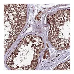 Atlas Antibodies Anti-ZNF766 Antibody