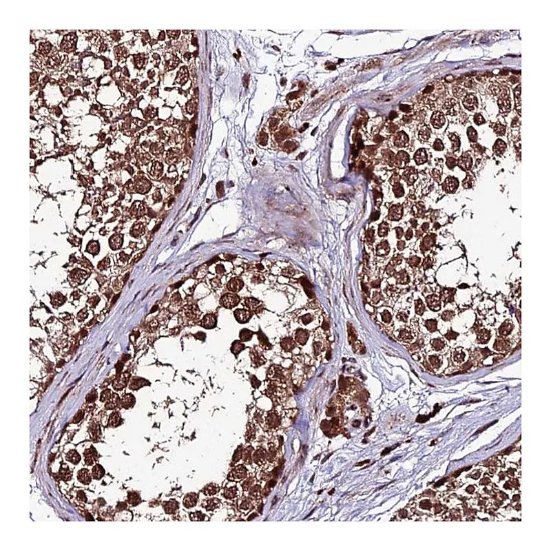 Atlas Antibodies Anti-ZNF766 Antibody