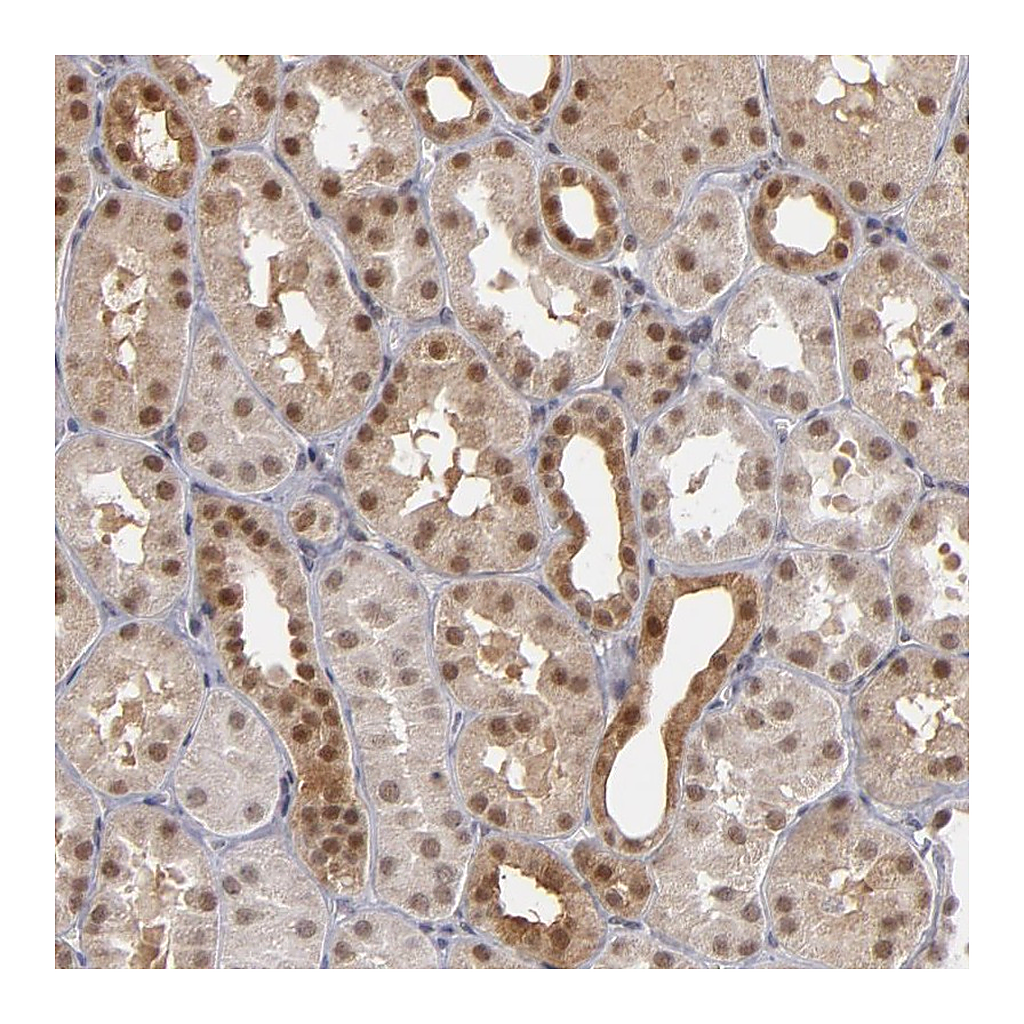 Atlas Antibodies Anti-ZNF75A Antibody