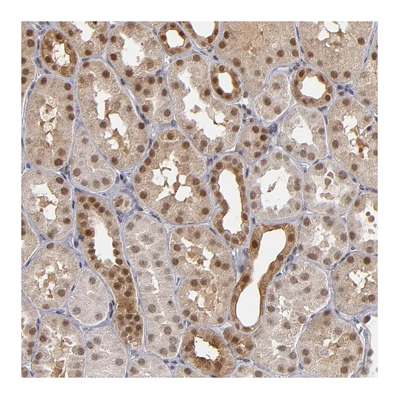 Atlas Antibodies Anti-ZNF75A Antibody