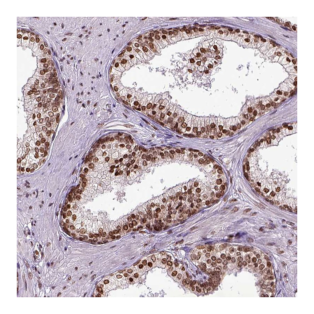 Atlas Antibodies Anti-ZNF75D Antibody