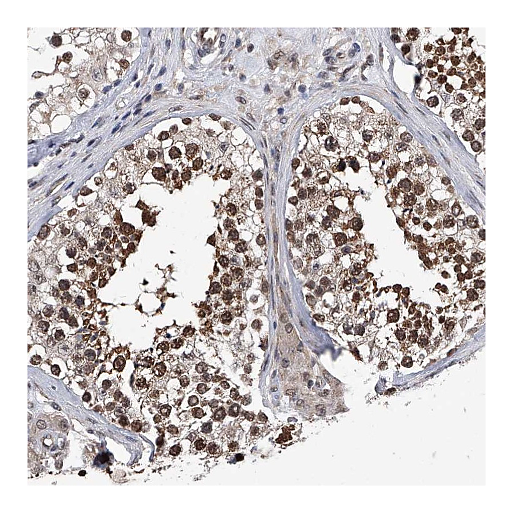 Atlas Antibodies Anti-ZNF76 Antibody