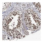Atlas Antibodies Anti-ZNF76 Antibody