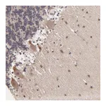 Atlas Antibodies Anti-ZNF764 Antibody