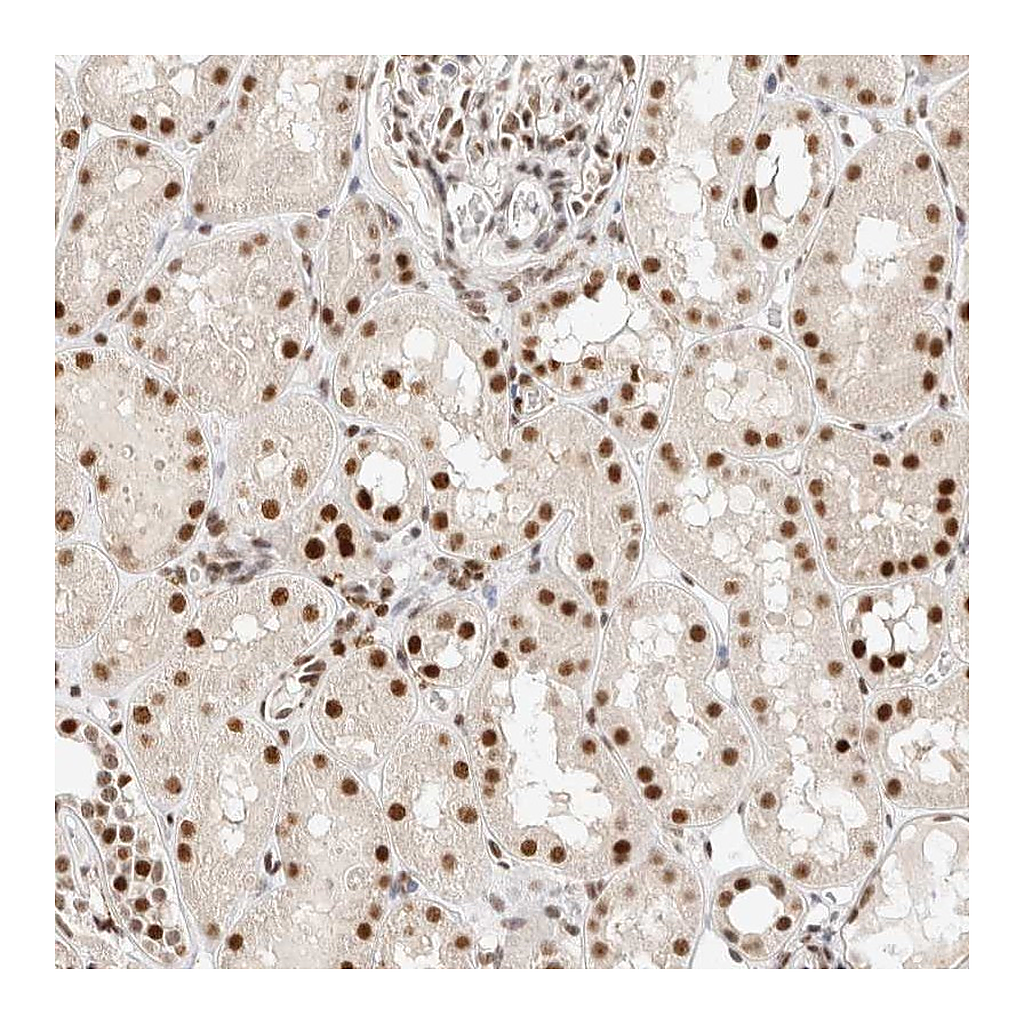 Atlas Antibodies Anti-ZNF768 Antibody