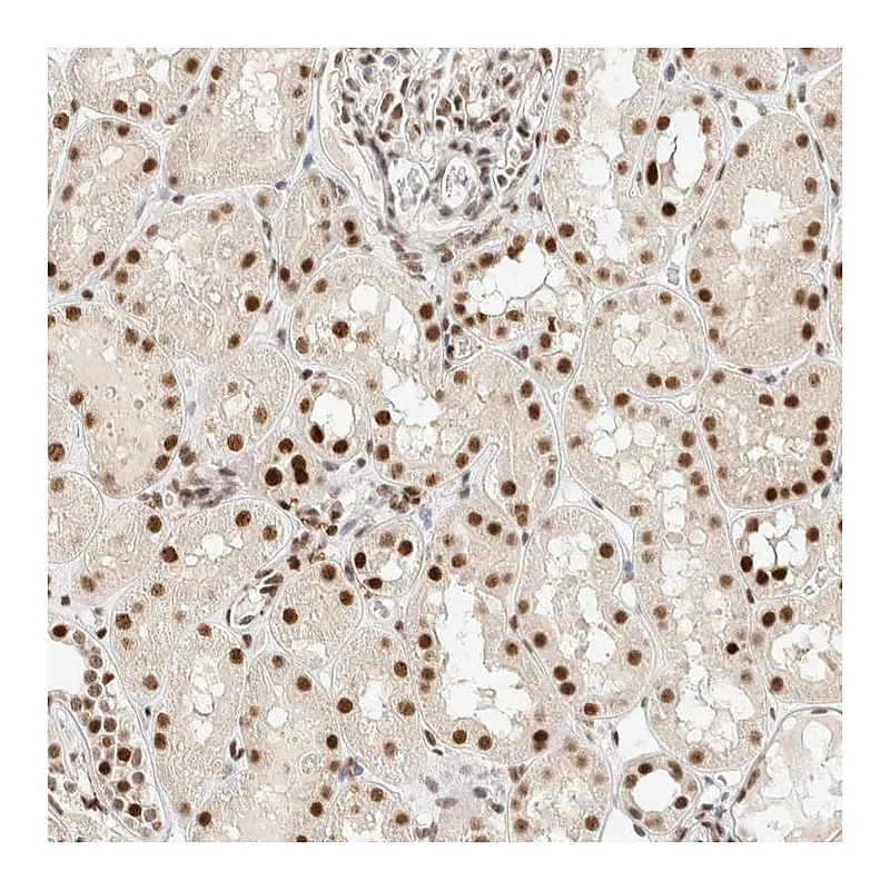 Atlas Antibodies Anti-ZNF768 Antibody