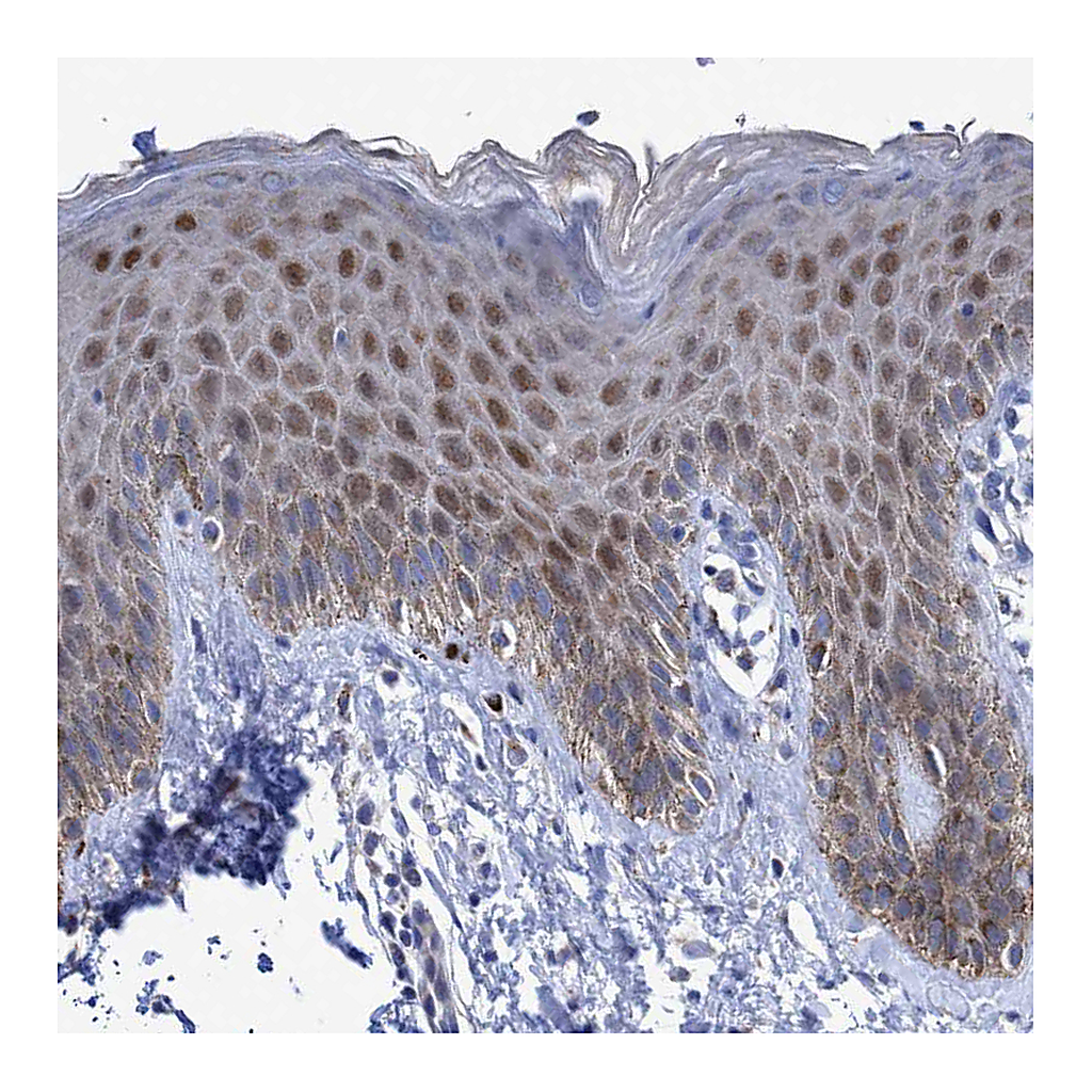 Atlas Antibodies Anti-ZNF750 Antibody