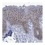 Atlas Antibodies Anti-ZNF750 Antibody