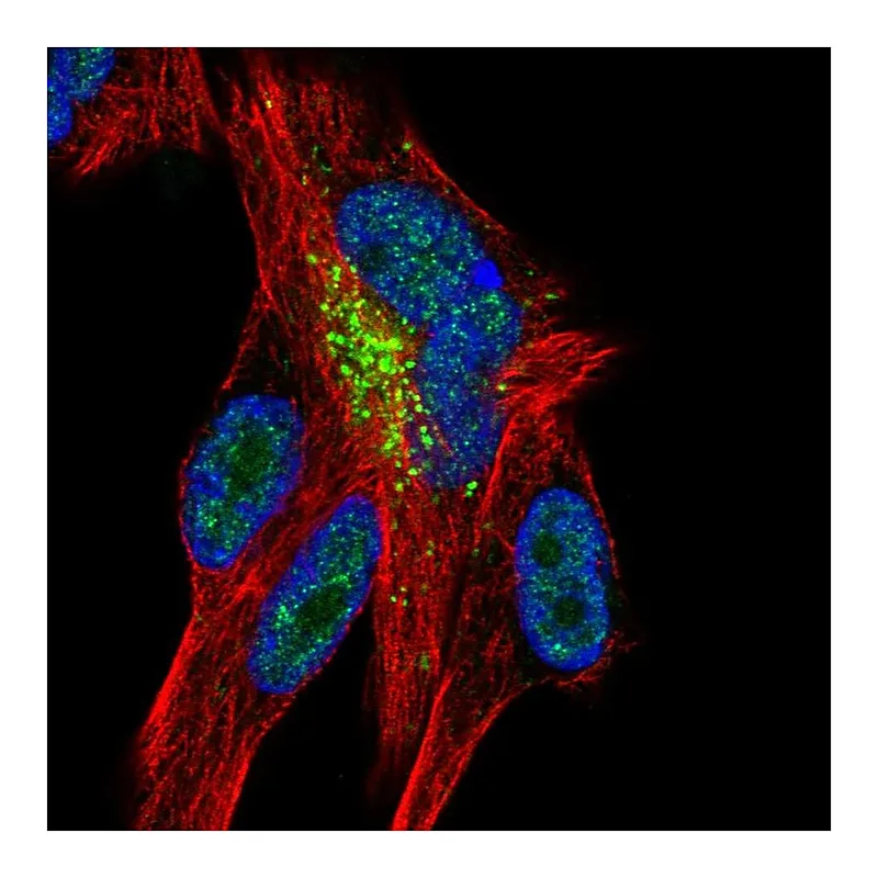 Atlas Antibodies Anti-ZNF768 Antibody