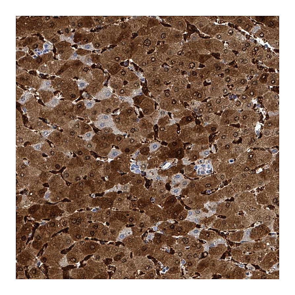 Atlas Antibodies Anti-ZNF771 Antibody
