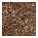 Atlas Antibodies Anti-ZNF771 Antibody