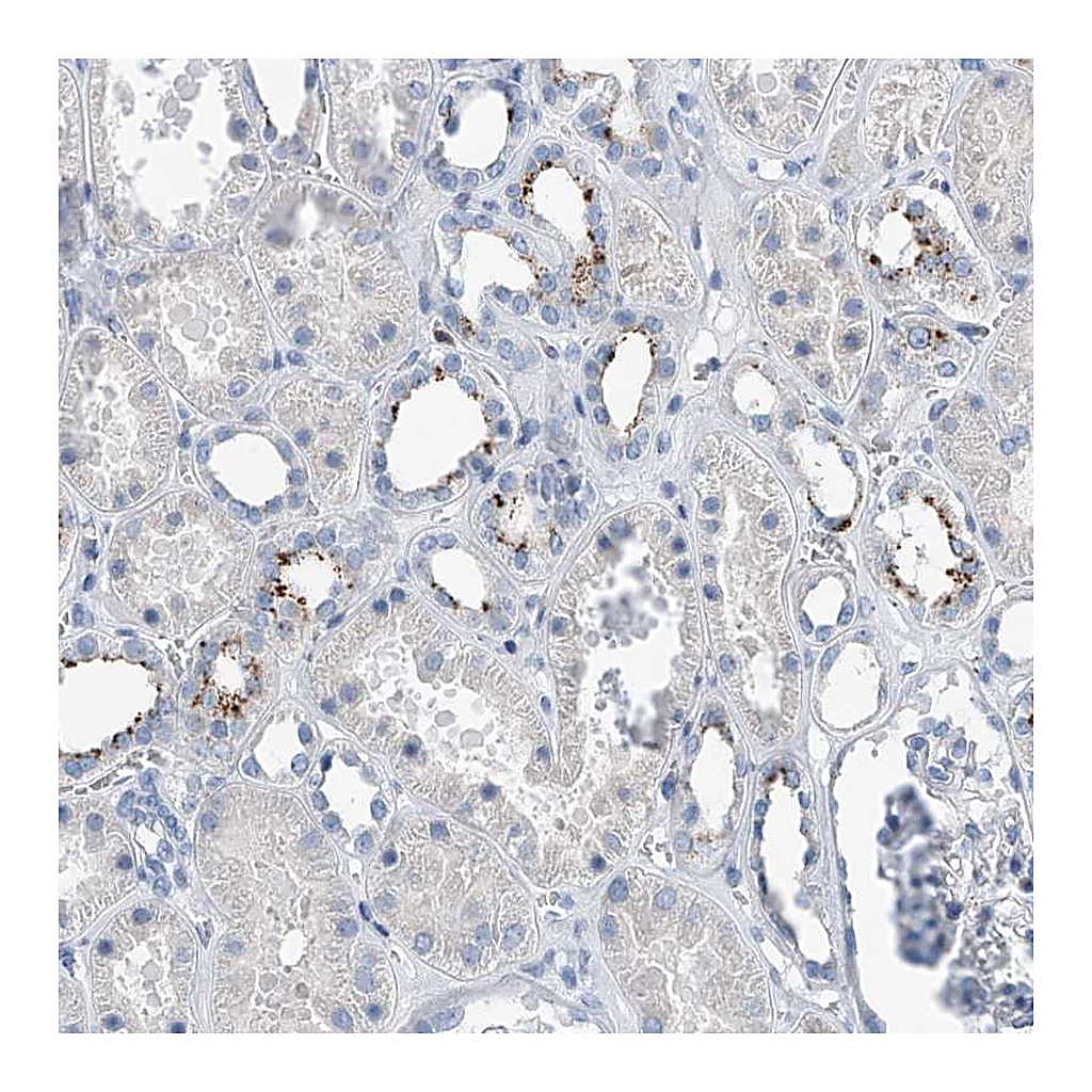Atlas Antibodies Anti-ZNF772 Antibody