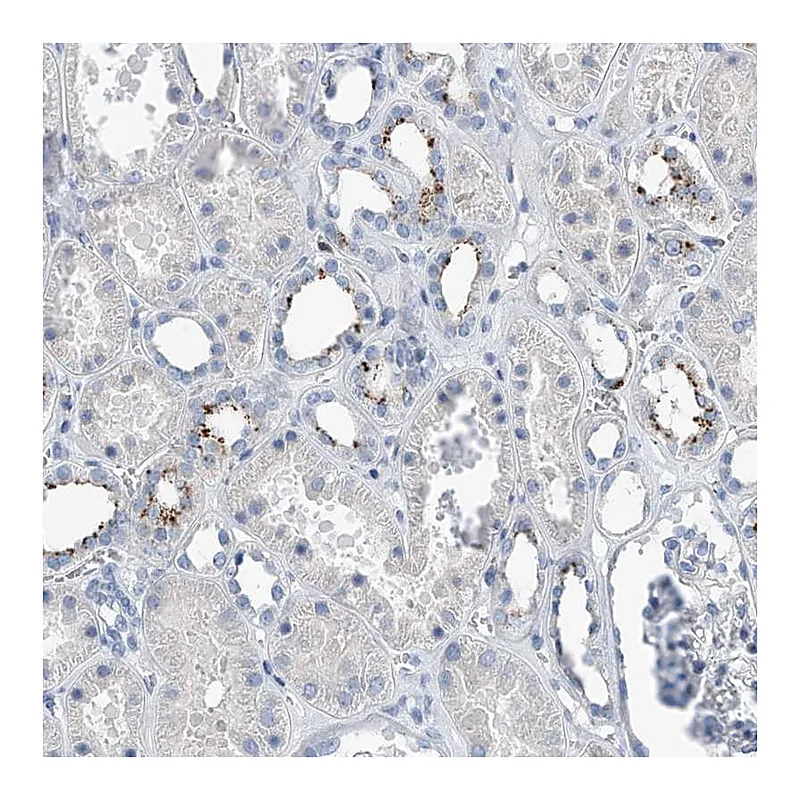 Atlas Antibodies Anti-ZNF772 Antibody