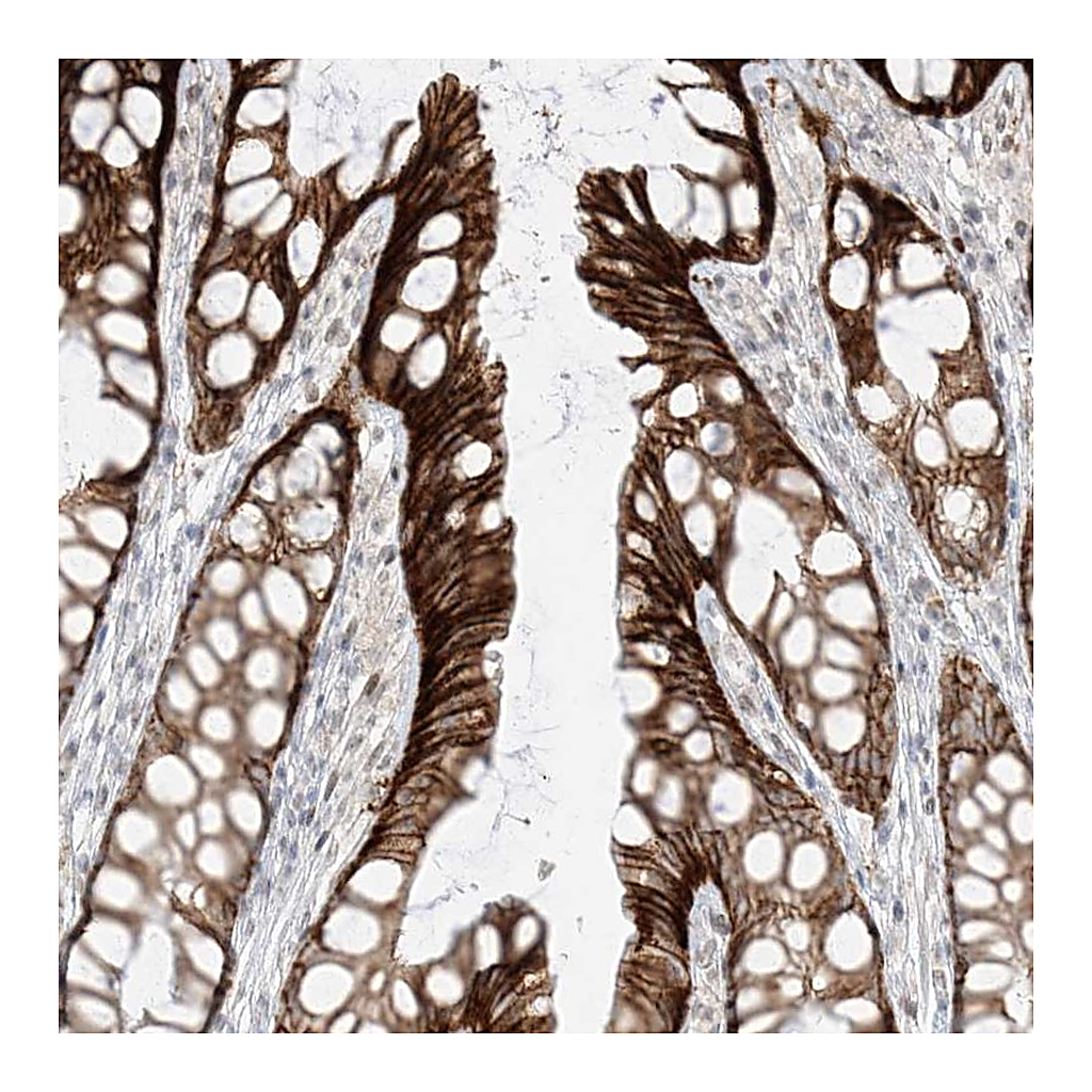 Atlas Antibodies Anti-ZNF774 Antibody