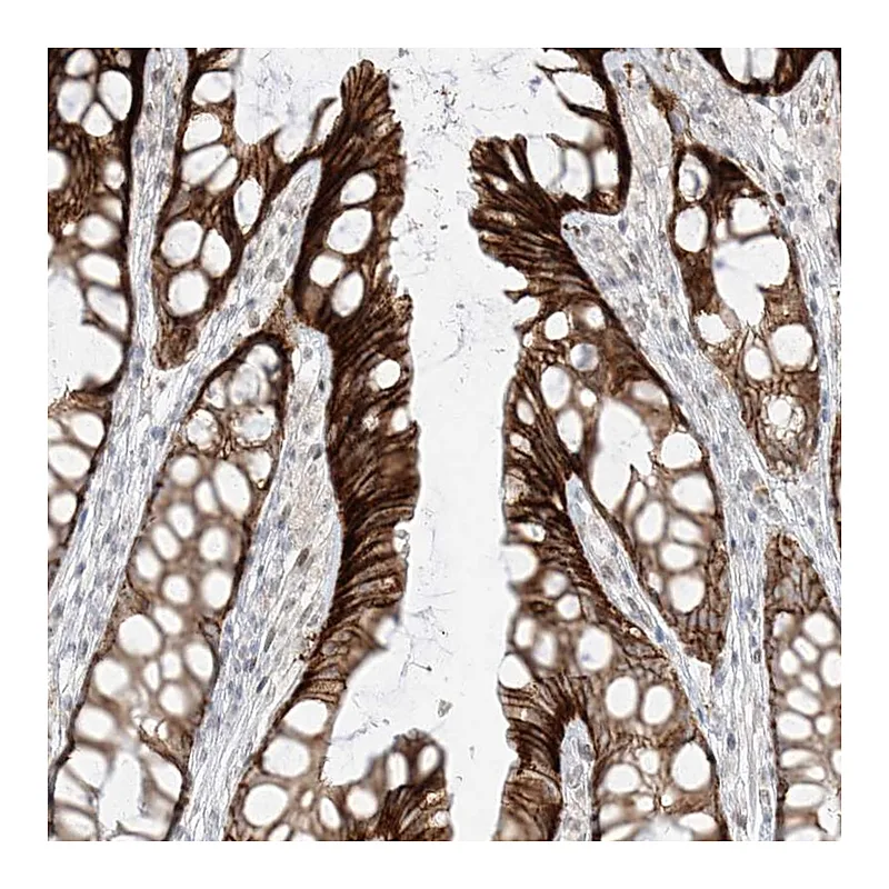 Atlas Antibodies Anti-ZNF774 Antibody