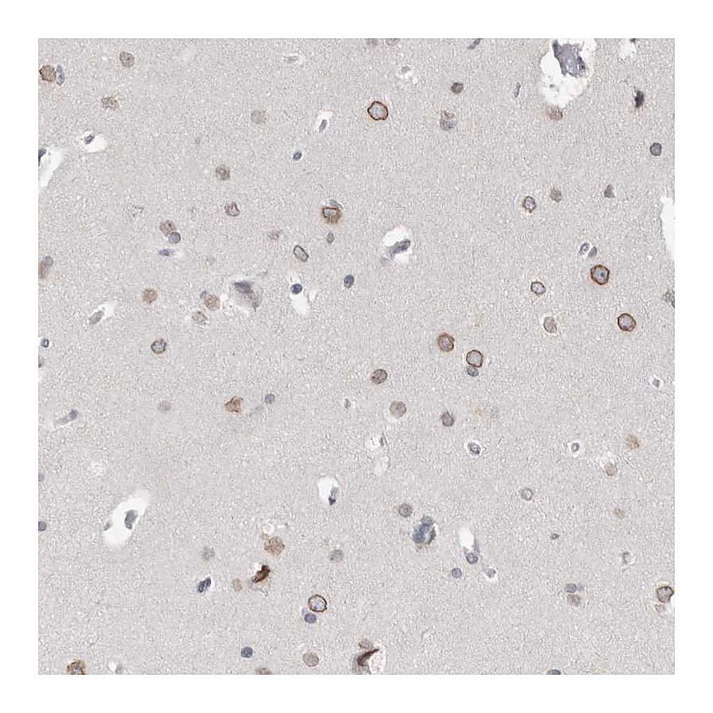 Atlas Antibodies Anti-ZNF770 Antibody