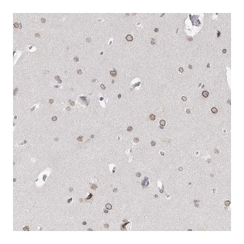 Atlas Antibodies Anti-ZNF770 Antibody