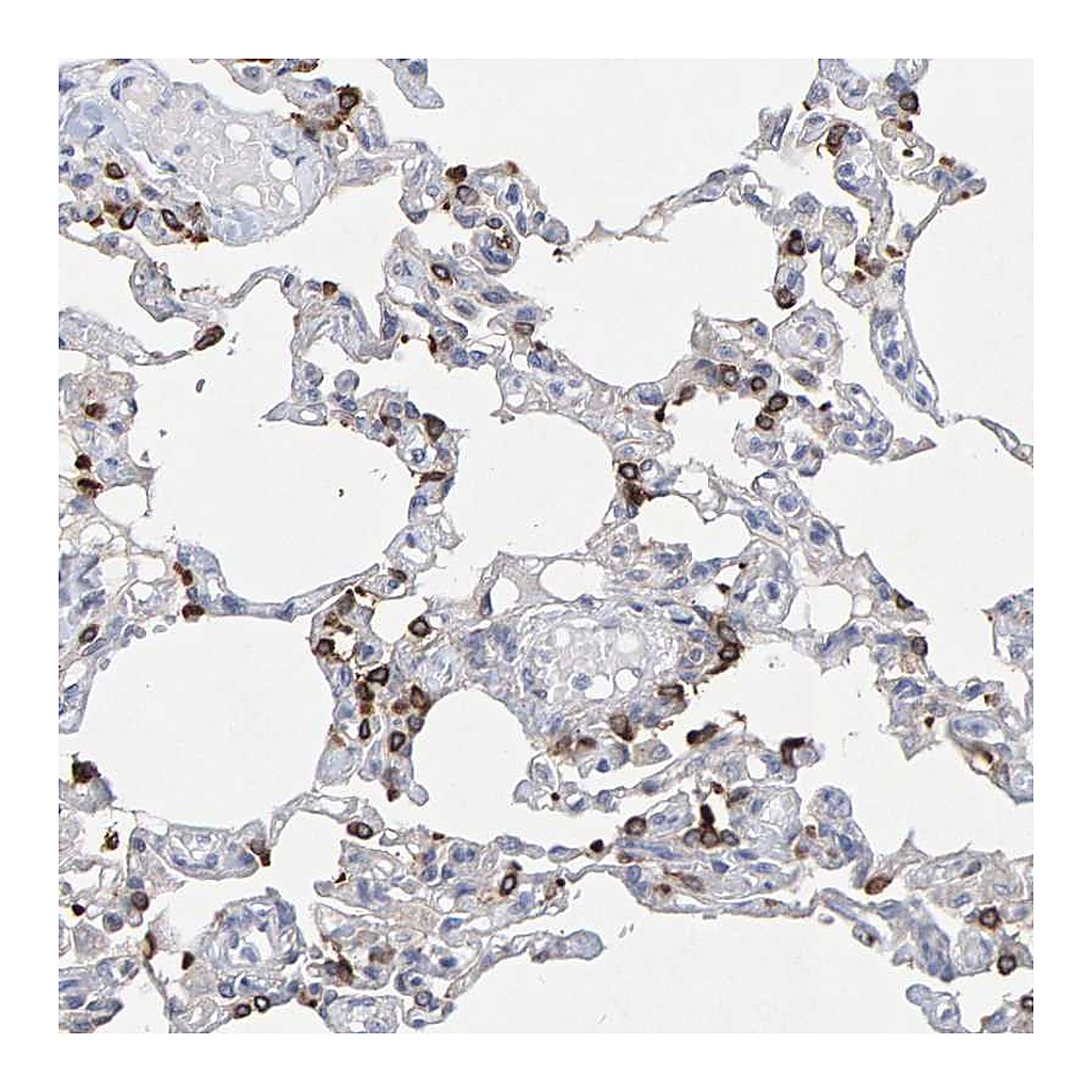 Atlas Antibodies Anti-ZNF77 Antibody