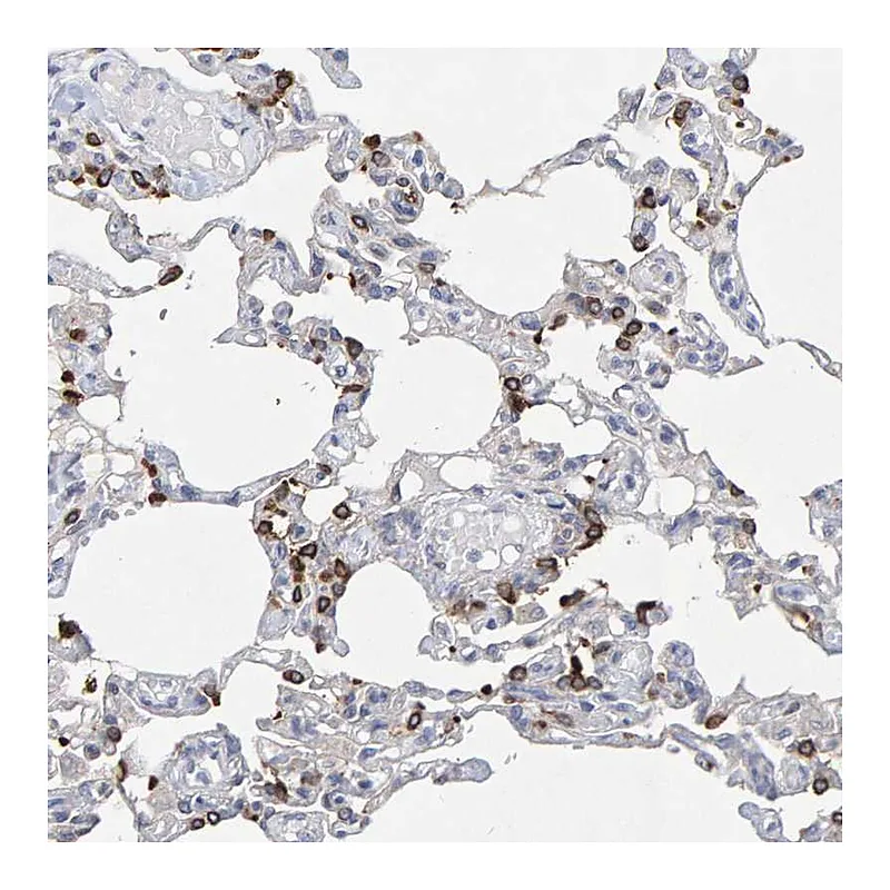 Atlas Antibodies Anti-ZNF77 Antibody