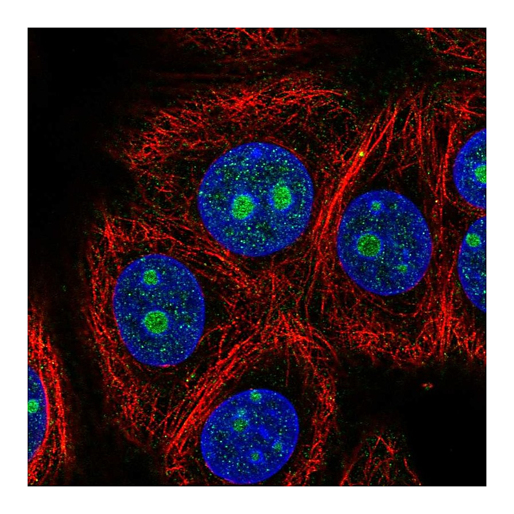 Atlas Antibodies Anti-ZNF771 Antibody