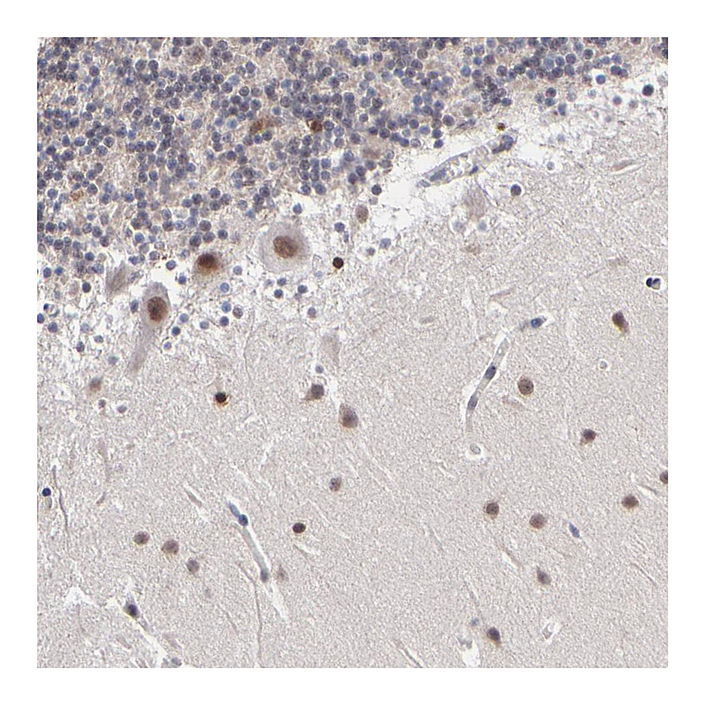 Atlas Antibodies Anti-ZNF773 Antibody