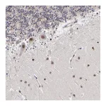 Atlas Antibodies Anti-ZNF773 Antibody