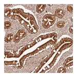 Atlas Antibodies Anti-ZNF776 Antibody