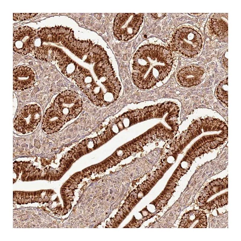 Atlas Antibodies Anti-ZNF776 Antibody