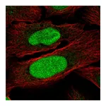Atlas Antibodies Anti-ZNF776 Antibody