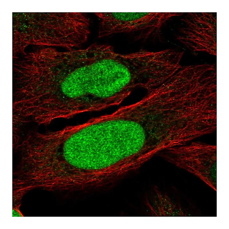 Atlas Antibodies Anti-ZNF776 Antibody