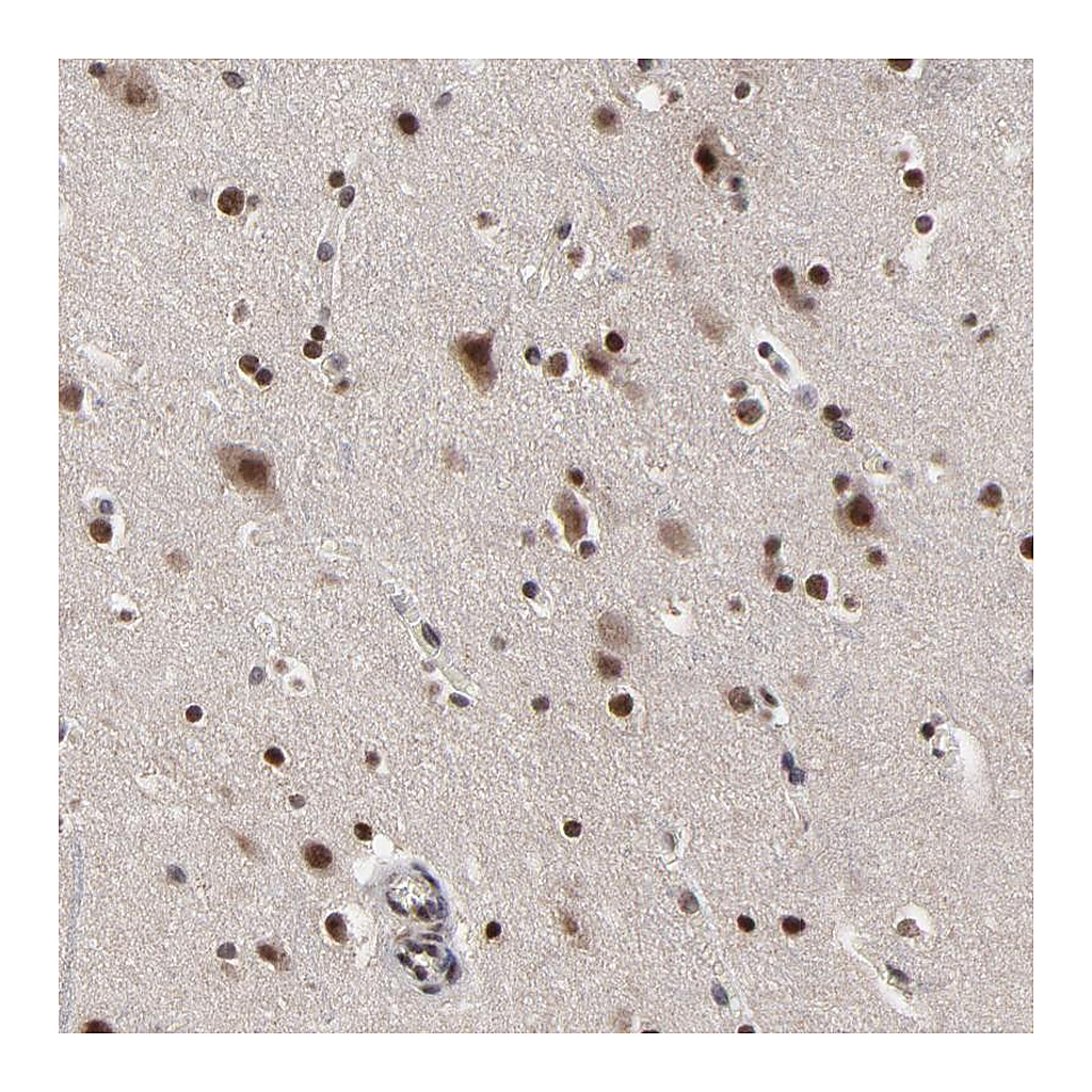 Atlas Antibodies Anti-ZNF777 Antibody