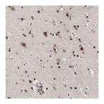 Atlas Antibodies Anti-ZNF777 Antibody