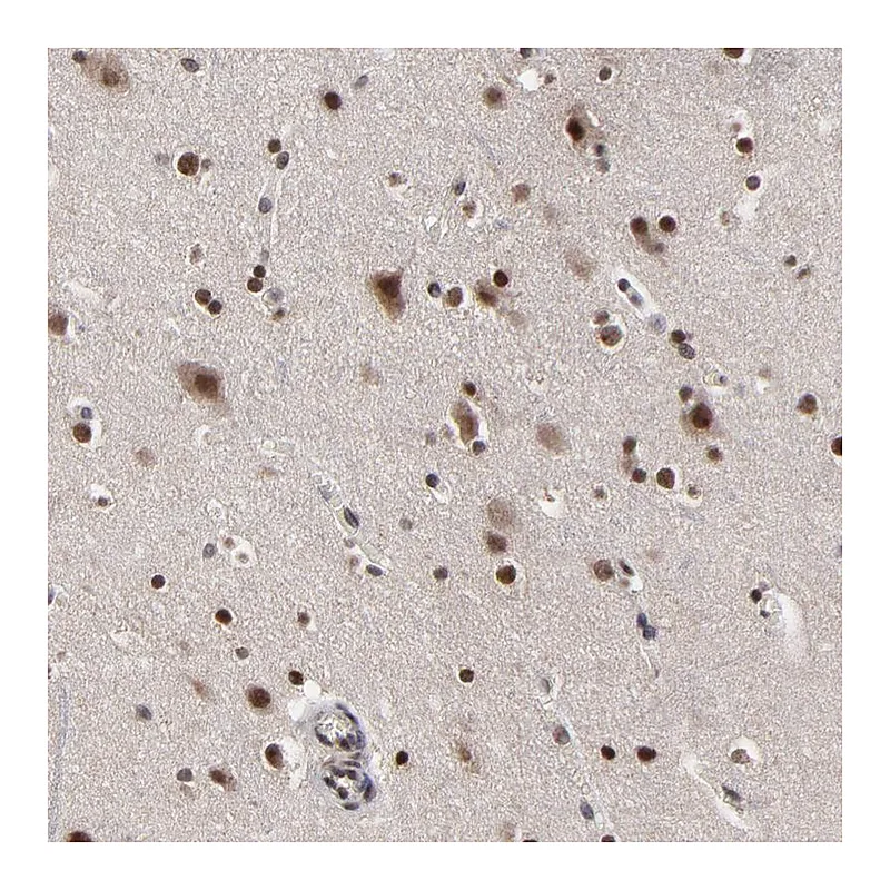 Atlas Antibodies Anti-ZNF777 Antibody