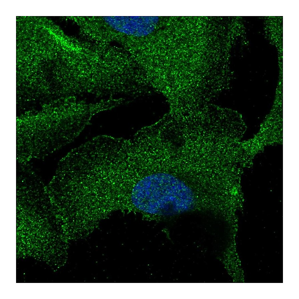 Atlas Antibodies Anti-ZNF785 Antibody