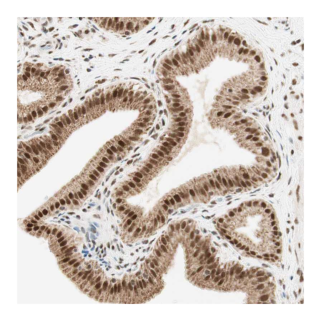 Atlas Antibodies Anti-ZNF782 Antibody