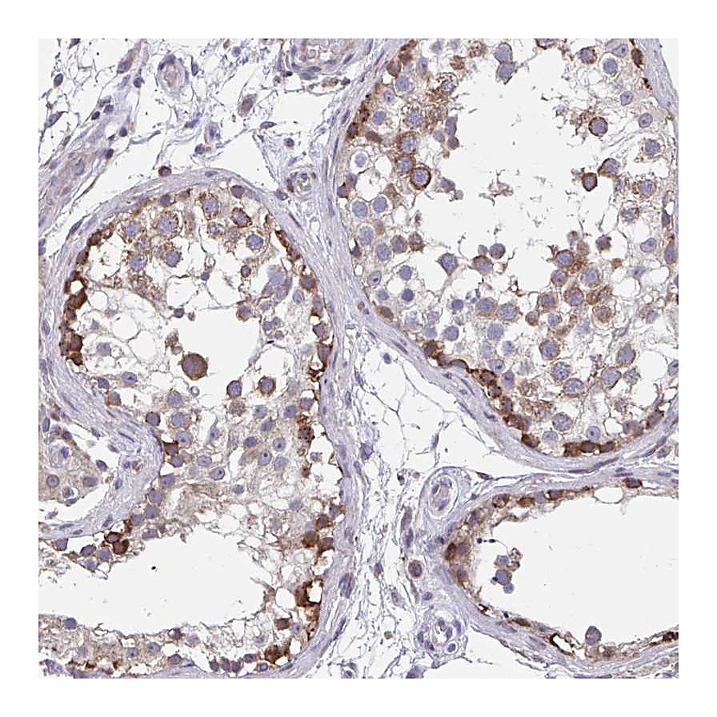 Atlas Antibodies Anti-ZNF778 Antibody