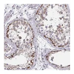 Atlas Antibodies Anti-ZNF778 Antibody