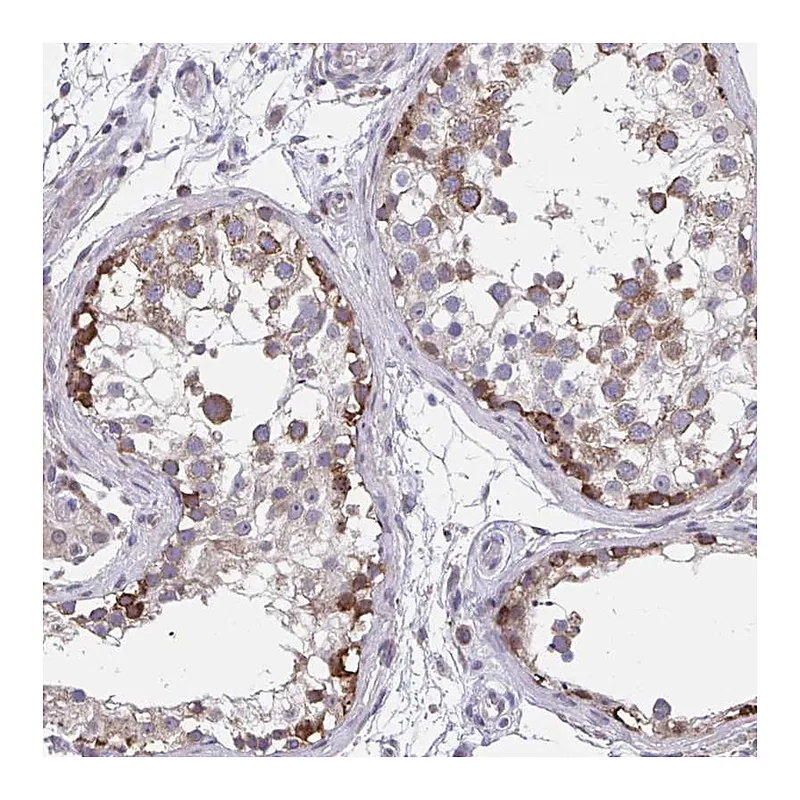 Atlas Antibodies Anti-ZNF778 Antibody