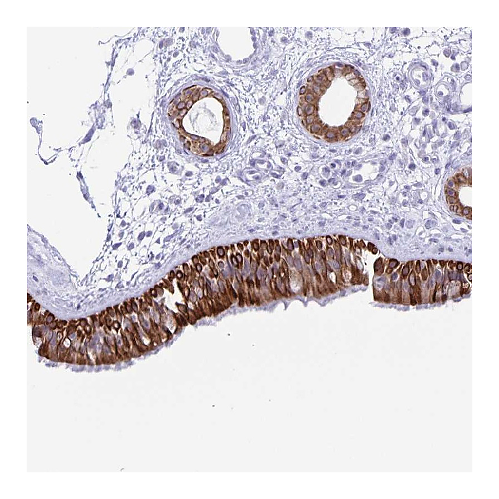 Atlas Antibodies Anti-ZNF781 Antibody
