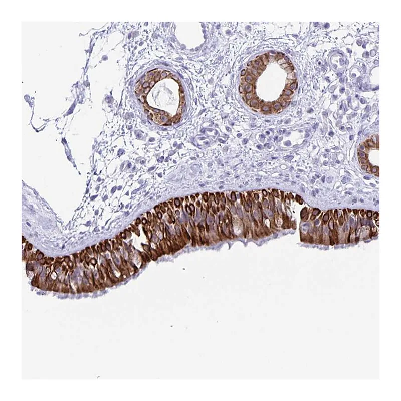 Atlas Antibodies Anti-ZNF781 Antibody