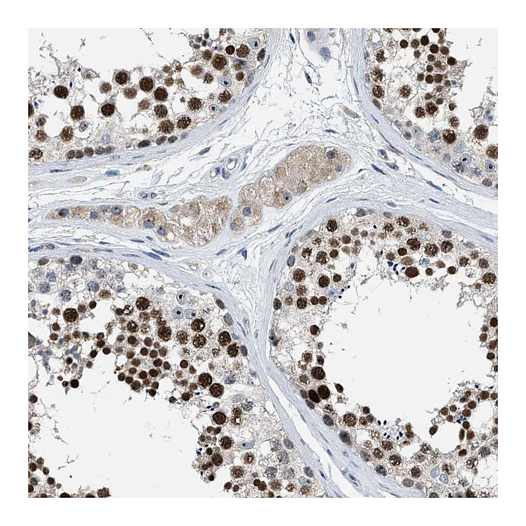 Atlas Antibodies Anti-ZNF783 Antibody