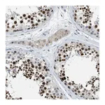 Atlas Antibodies Anti-ZNF783 Antibody