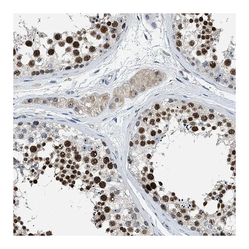 Atlas Antibodies Anti-ZNF783 Antibody