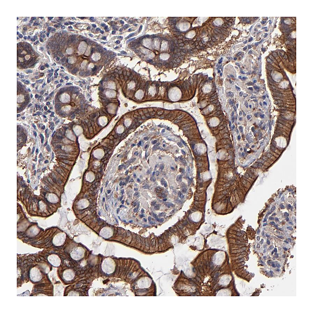 Atlas Antibodies Anti-ZNF780B Antibody